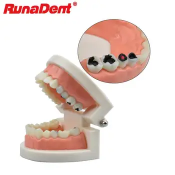 Zobozdravnik Študent Gnilobo Model Zobne Votline Model Standard Zob Model Otrok Otrok Poučevanja, Študija Predstavitev Orodja